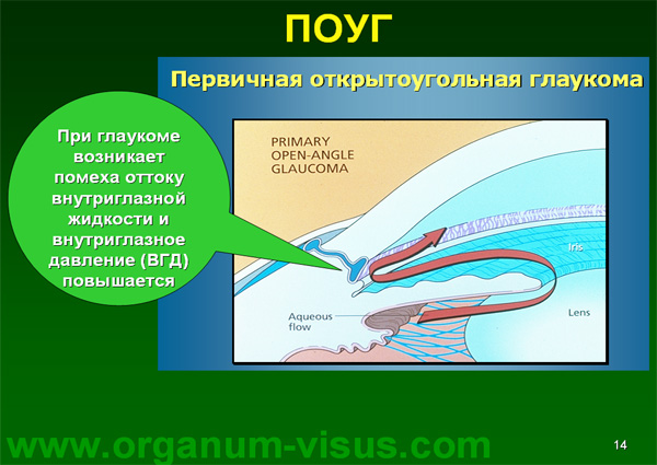 Organum-visus_Глаукома_Школа офтальмологического пациента_2008_1003_Лечение глаукомы_Глазные капли_Проcтагландины_Латанопрост_Травопрост_Ксалатан_Траватан_Тимолол_Образ жизни при глаукоме_Glaucoma
