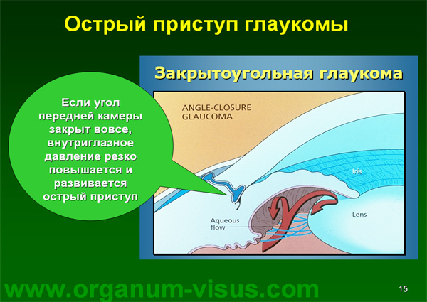 Organum-visus_Глаукома_Школа офтальмологического пациента_2008_1003_Лечение глаукомы_Глазные капли_Проcтагландины_Латанопрост_Травопрост_Ксалатан_Траватан_Тимолол_Образ жизни при глаукоме_Glaucoma