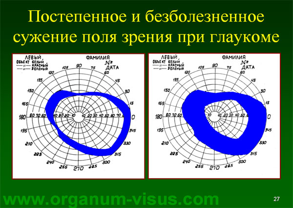 Organum-visus_Глаукома_Школа офтальмологического пациента_2008_1003_Лечение глаукомы_Глазные капли_Проcтагландины_Латанопрост_Травопрост_Ксалатан_Траватан_Тимолол_Образ жизни при глаукоме_Glaucoma
