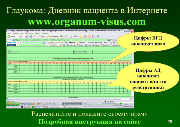Organum-visus_Глаукома_Школа офтальмологического пациента_2008_1003_Лечение глаукомы_Глазные капли_Проcтагландины_Латанопрост_Травопрост_Ксалатан_Траватан_Тимолол_Образ жизни при глаукоме_Glaucoma