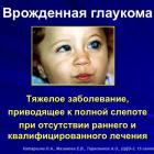 Катаргина Л.А., Мазанова Е.В., Тарасенков А.О. Врожденная глаукома: клинические проявления, этиология, классификация, современные методы диагностики, дифференциальный диагноз ”большого глаза’. Школа детского офтальмолога, 15.09.2016, Москва. Информационный партнер портал Орган зрения organum-visus.ru (рис.2)