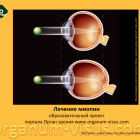 Myopia treatment. Лечение миопии у детей. Новости офтальмологии портала Орган зрения www.organum-visus.com