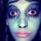 Exophthalmos?