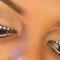 Дорога к блефариту (Road to blepharitis)?