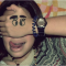 Strabismus.