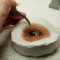 Глазное протезирование, eye Prosthetics.