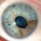 Melanoma uveal (увеальная меланома). Новости офтальмологии портала Орган зрения www.organum-visus.com 