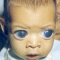 Врожденная глаукома (congenital glaucoma). Новости офтальмологии портала Орган зрения www.organum-visus.com